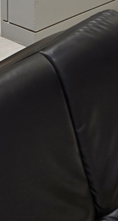 임플란트 뼈이식 안하면 어떤 문제가 있는거죠 관련 이미지 49