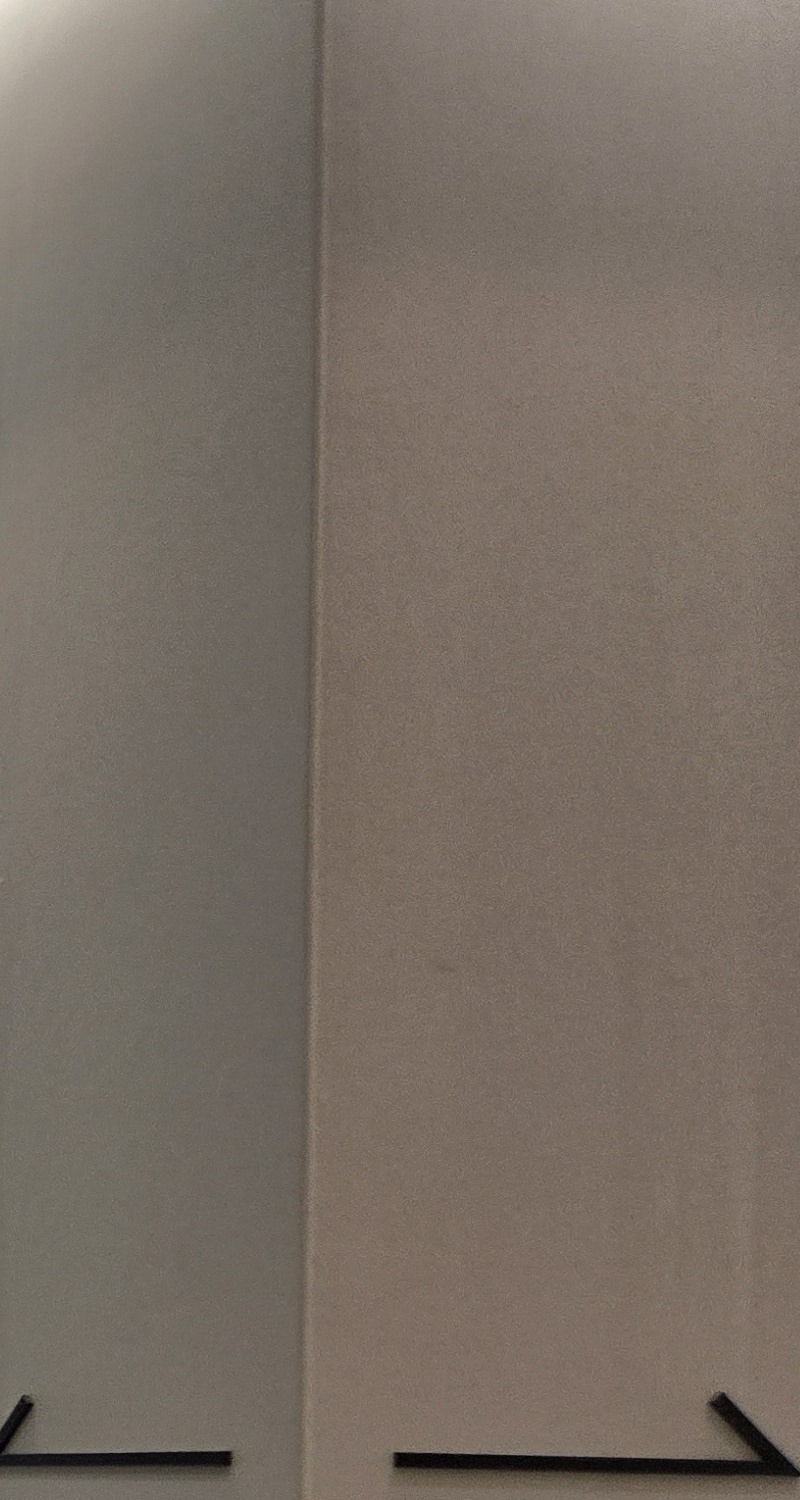 과개교합 교정 후 얼굴형 얼마나 바뀌나요 관련 이미지 16