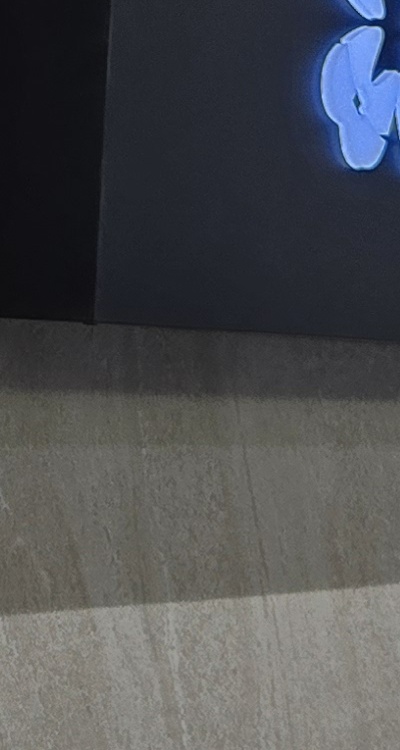 앞니 신경치료 크라운 까지 해야할 상황이라면 관련 이미지 36