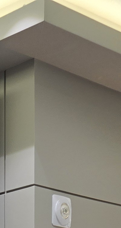 임플란트 뼈이식 안하면 어떤 문제가 있는거죠 관련 이미지 19