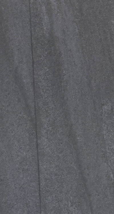 임플란트의 장점 할까 말까 고민이신 분들을 위한 정리 관련 이미지 30