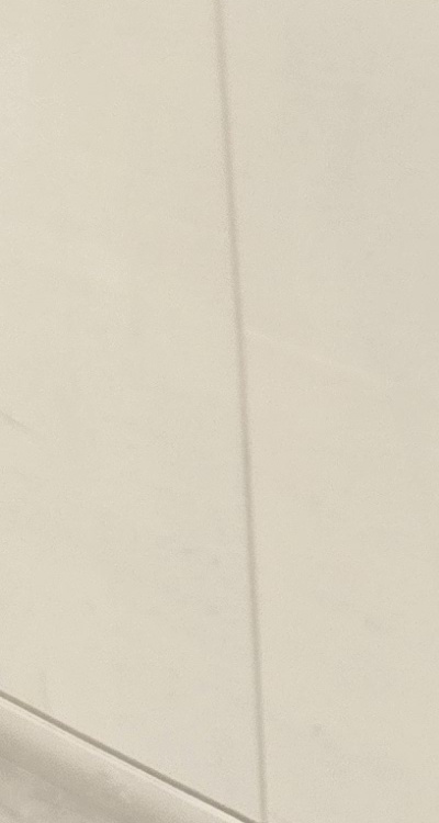 송곳니 크라운 티가 안나게 해결 가능한건가요 관련 이미지 31