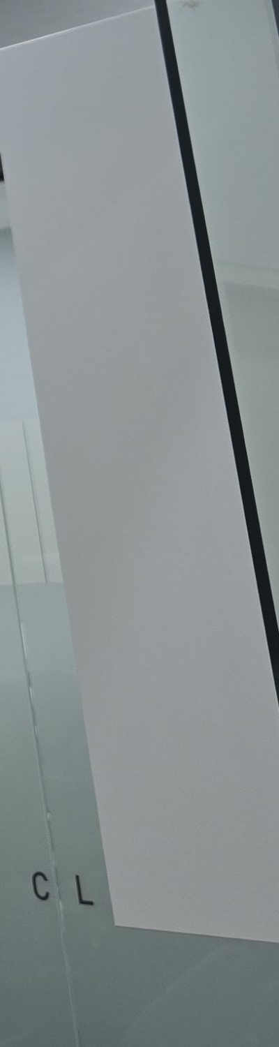 앞니 크라운 교체 깔끔하게 정리하려면 관련 이미지 26