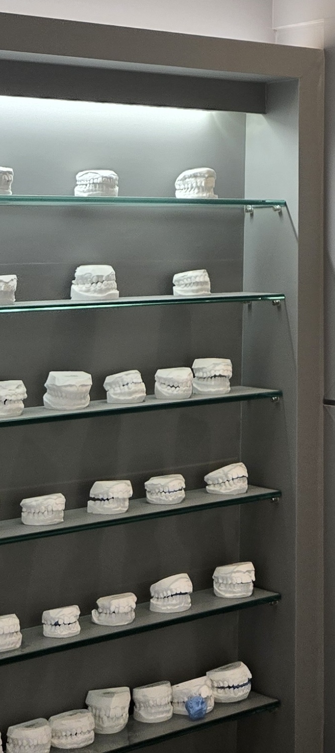 어금니 임플란트 뼈이식 이럴때 해당됩니다 관련 이미지 29