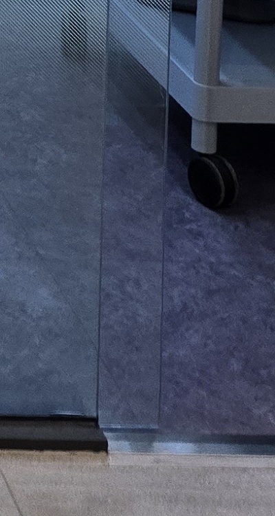 앞니 올세라믹 이건 알고 시작하세요 관련 이미지 47