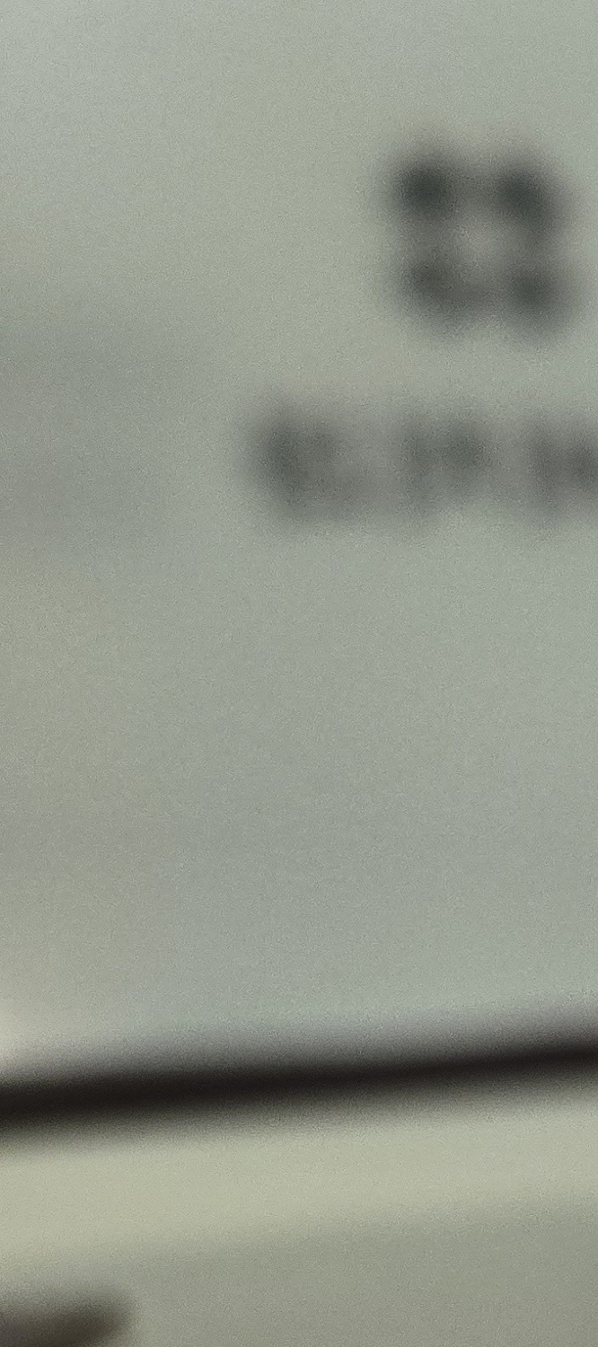 송곳니 덧니 발치 이럴때 해당되네요 관련 이미지 24
