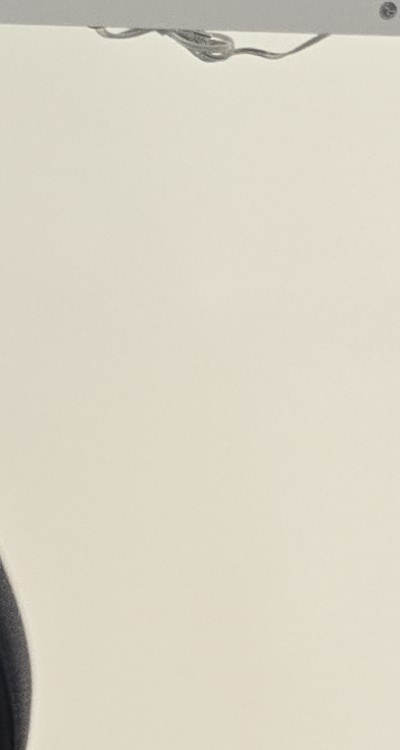 어금니 임플란트 안하면 후회하게 되는걸까 관련 이미지 19