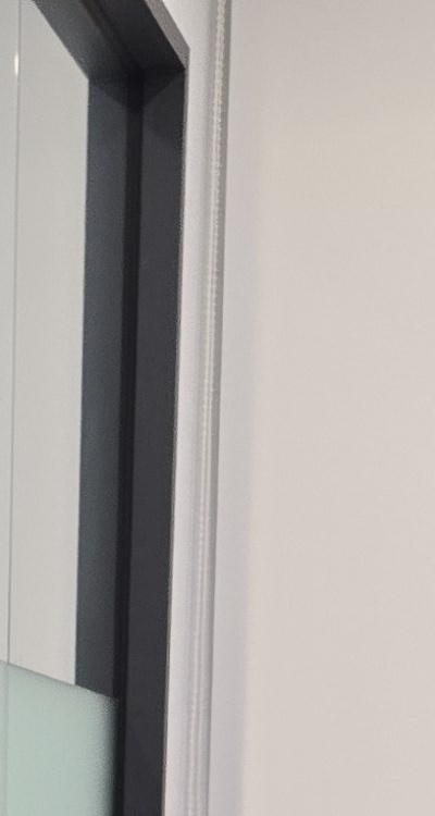 충치 검은점 나타났다면 이렇게 대처해요 관련 이미지 17