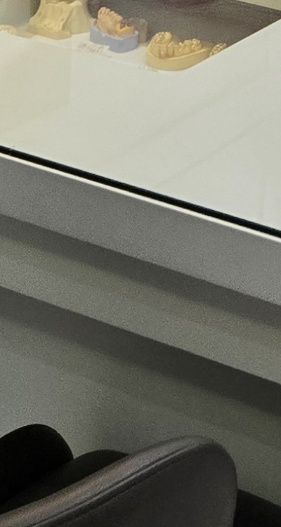 아래 사랑니 발치 통증 미리 알고 대처하려면 관련 이미지 42