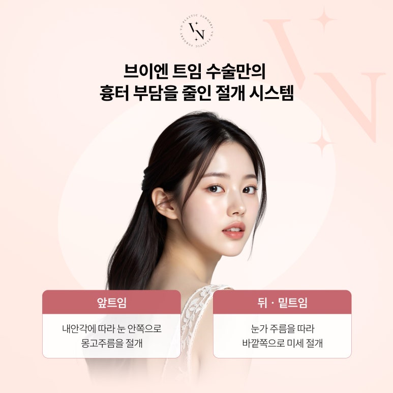 트임수술, 어떤 경우에 필요할까? 관련 이미지 4