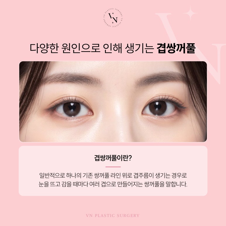 겹쌍꺼풀이 생기는 원인과 해결 방법 관련 이미지 2