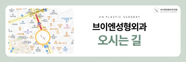VN Plastic Surgery: Want a sharper nasal tip? Bulbous nose correction image 8