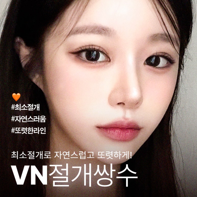 [Gangnam/Sinnonhyeon VN Plastic Surgery] Post-College Entrance Exam Double Eyelids Surgery Is Timed Perfectly Now! image 1