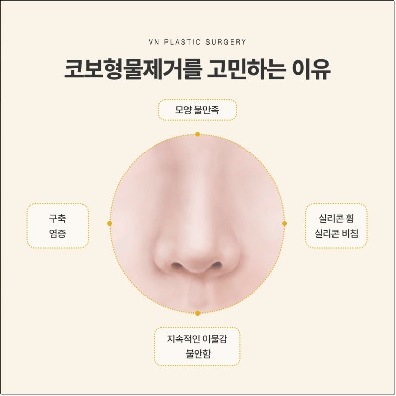 Types of Nasal Implant Removal to Know Before Revision Rhinoplasty | VN Plastic Surgery image 2