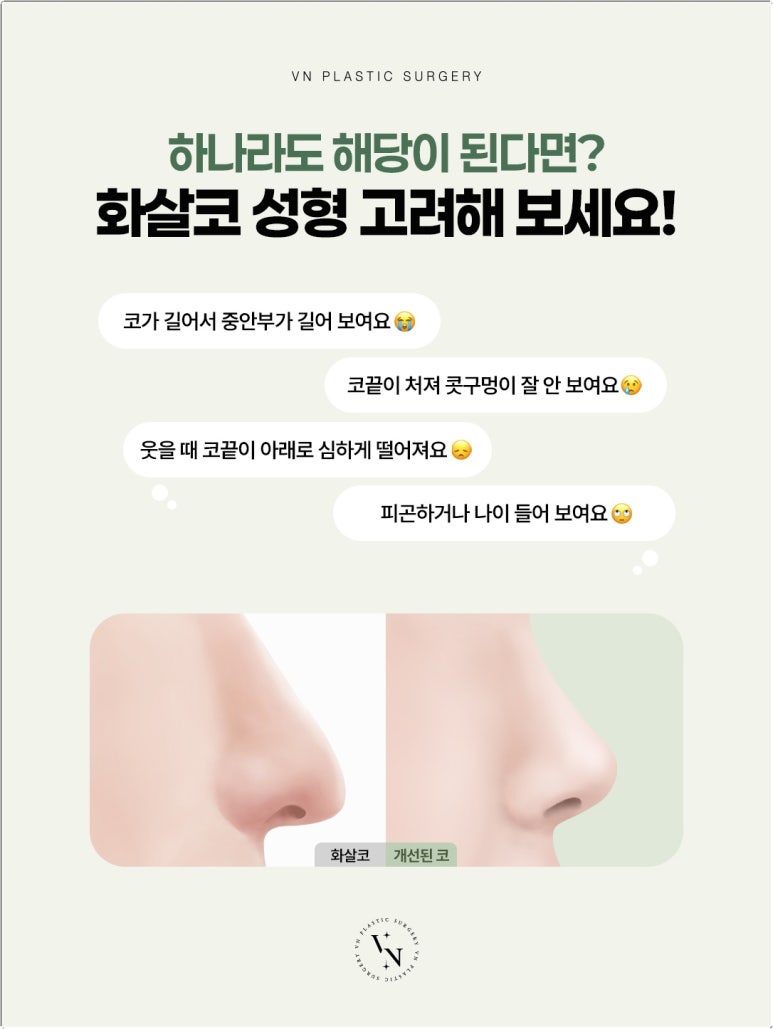 화살코수술, 코끝이 처져 보이는 이유부터 확인해 보세요 관련 이미지 2