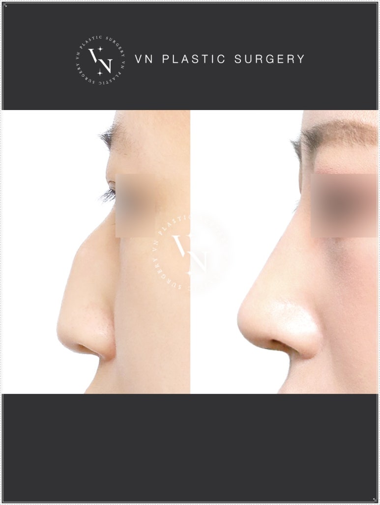 Turn Your Complexes into Confidence: How to Apply for the VN Plastic Surgery Real Model Program image 7