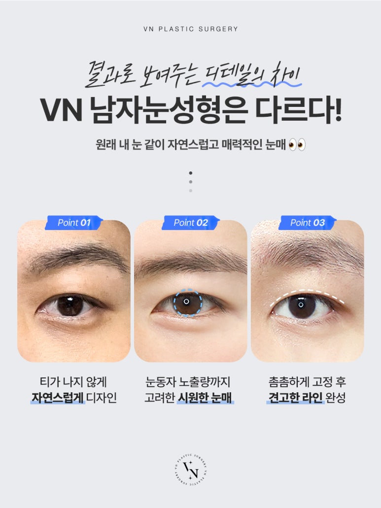 수험생도 부담 없이, 신논현성형외과 티 안 나는 남자눈성형 관련 이미지 2