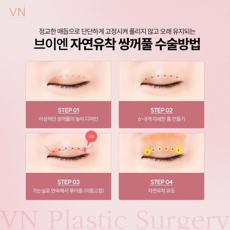 빠른회복과 자연스러움이 특징인 자연유착 쌍꺼풀수술 관련 이미지 3