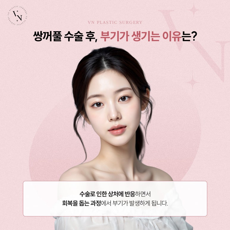 눈 성형 후 부기 빠지는 기간, 부위별로 다르다? 관련 이미지 2