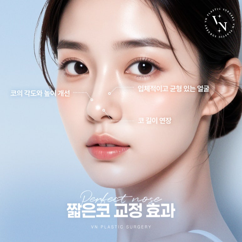 Short Nose Surgery at a Plastic Surgery Clinic in Sinnonhyeon: Key Points for Restoring Facial Proportions image 3