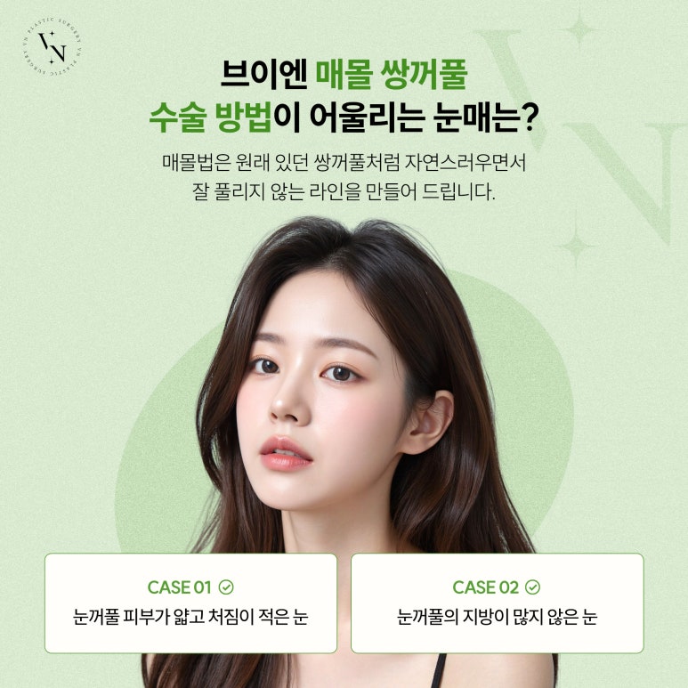 브이엔성형외과, 쌍꺼풀 수술, 부작용을 예방하고 싶다면? 관련 이미지 3