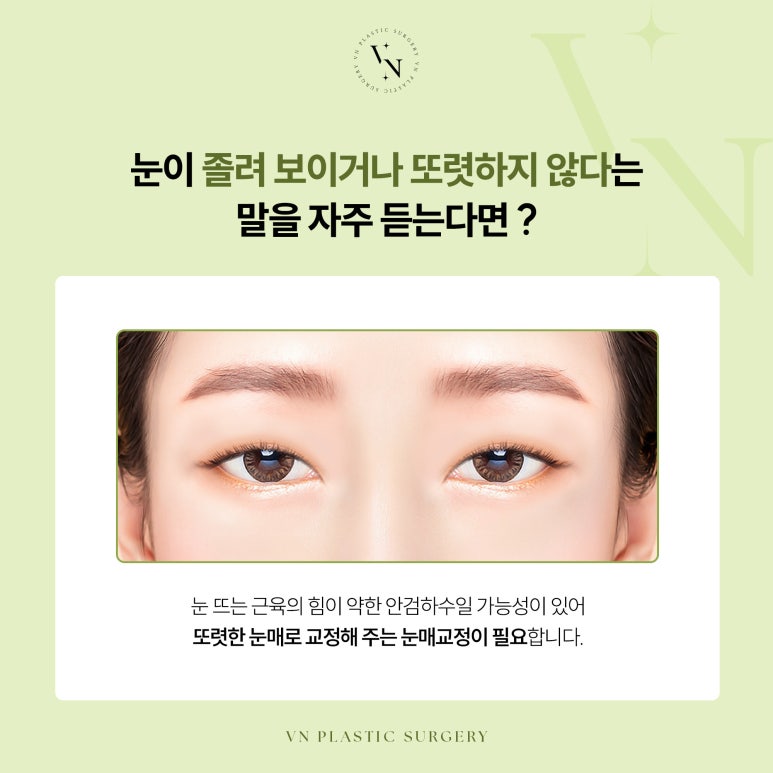 눈매교정, 비절개로도 가능한가요? 관련 이미지 2