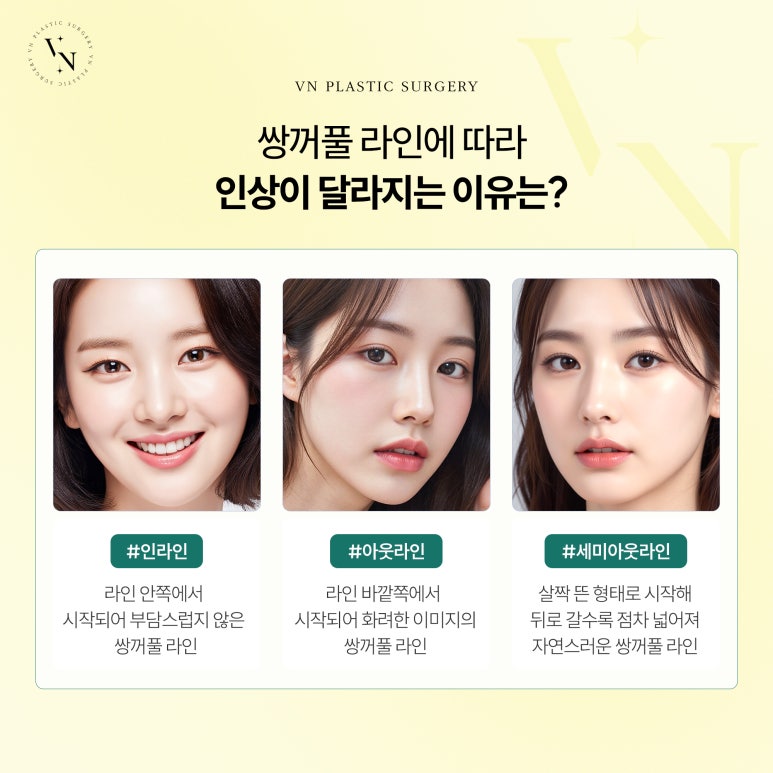 첫눈성형, 인라인 vs 아웃라인 vs 세미아웃 어떻게 고를까? 관련 이미지 2