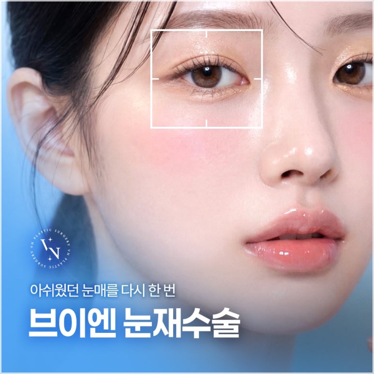 눈재수술성형외과, 원인부터 다르게 봐야 하는 이유 관련 이미지 1