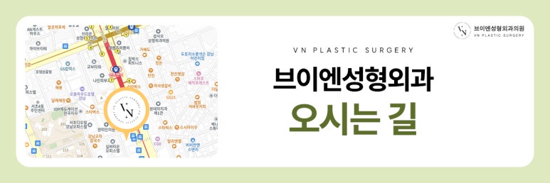 눈매교정, 비절개로도 가능한가요? 관련 이미지 9