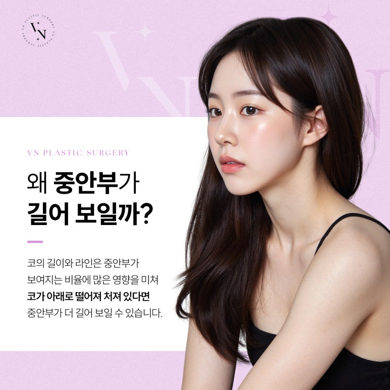 VN Plastic Surgery, Worried About a Long Midface? image 2