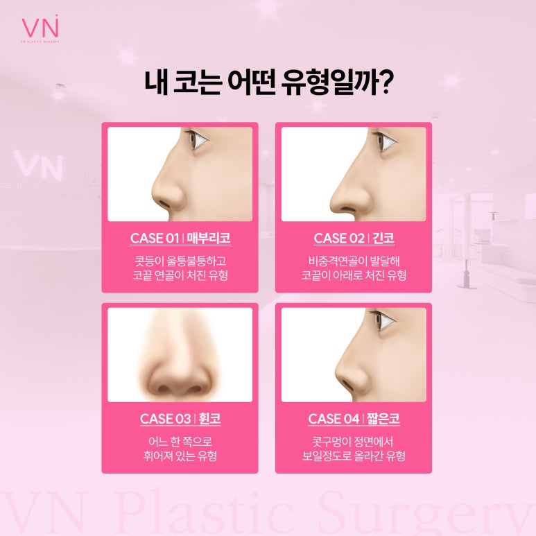 유형별로 알아보는 코수술, 나는 어떤 유형일까? 관련 이미지 2