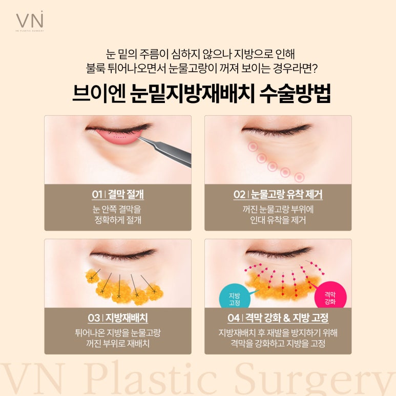 눈밑지방재배치, 노안에서 동안으로 관련 이미지 3