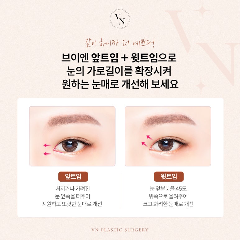 How Can a Fierce-Looking Eye Shape Be Corrected? image 4