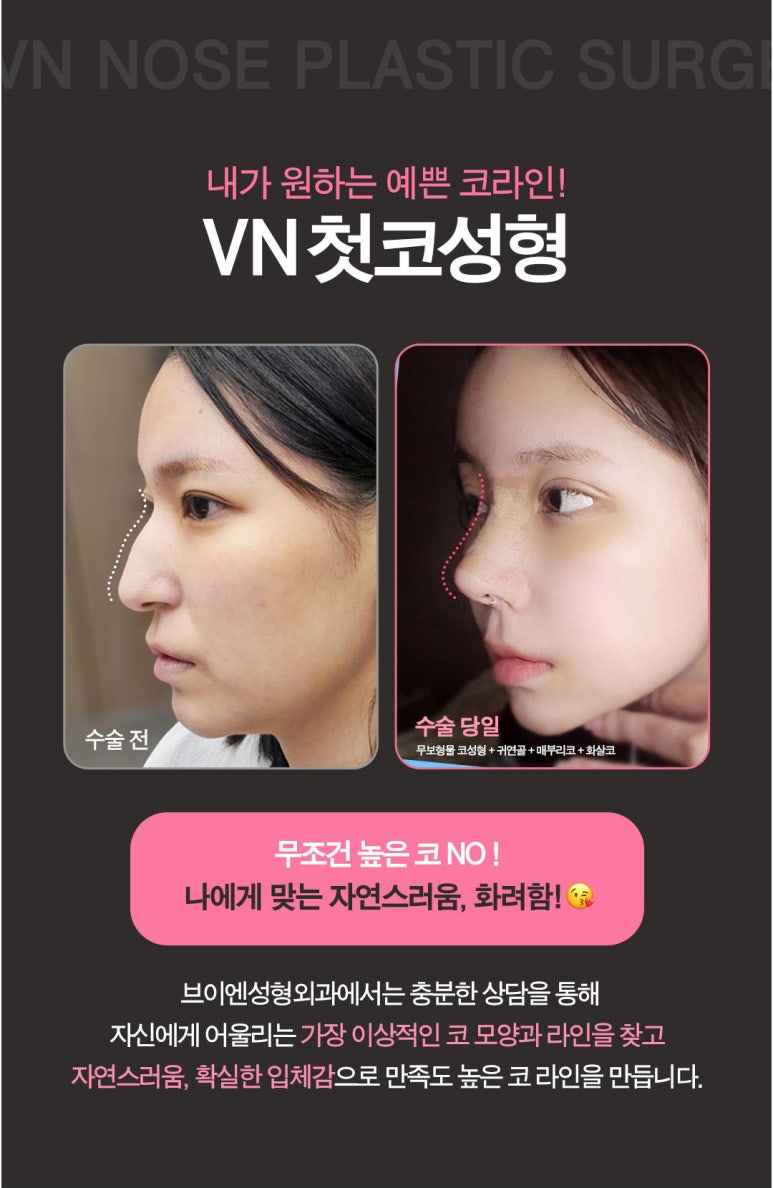 College Entrance Exam Nose Surgery Event with VN Plastic Surgery ๐๐ชฝ image 3