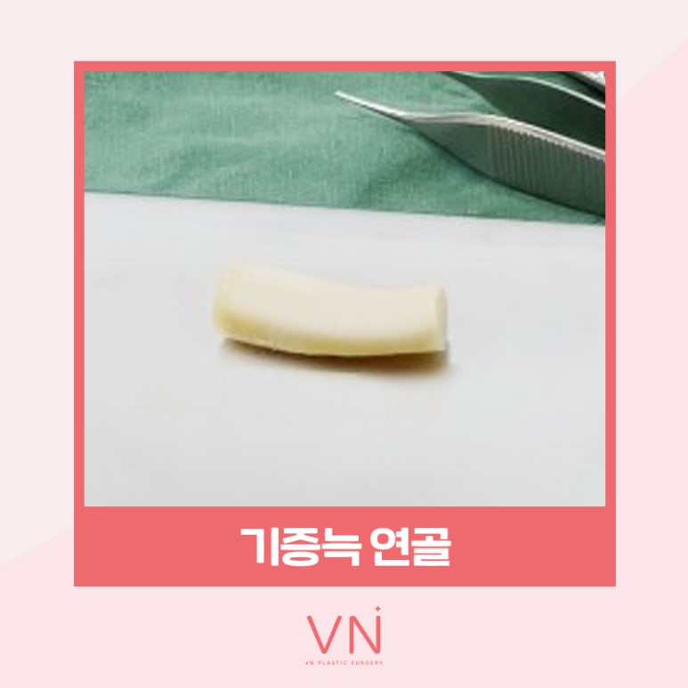 코성형수술 전이라면 클릭🖱 (feat. 수술재료 모아보기) 관련 이미지 3