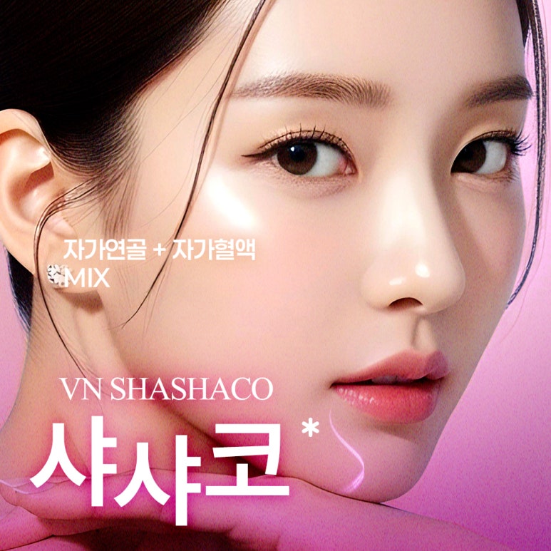 Closed Rhinoplasty Using Autologous Cartilage, Naturally Completed with VN Plastic Surgery’s ShashaKo ✨ image 1