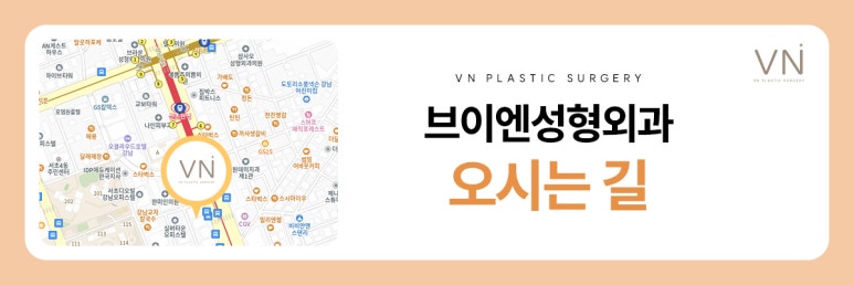 함몰눈과 돌출눈 중에 어떤 눈이 수술 결과가 좋을까? 관련 이미지 7