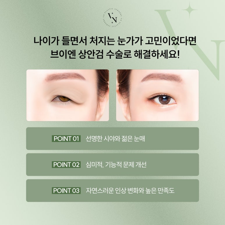 Vn Plastic Surgery: What Is the Solution to Concerns About Drooping Upper Eyelids? image 5
