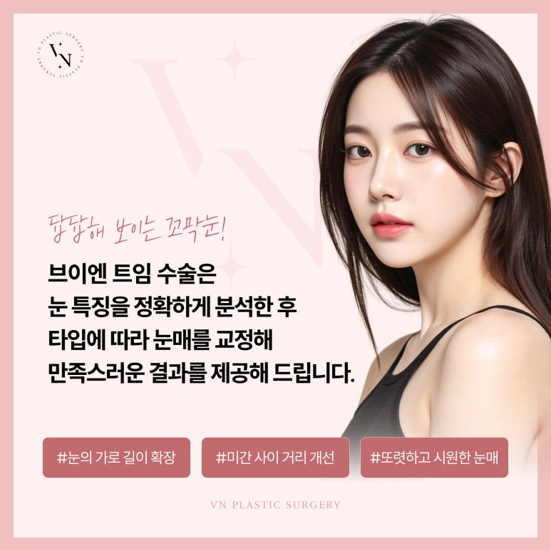 브이엔성형외과, 꼬막눈 개선하는 트임수술 관련 이미지 6