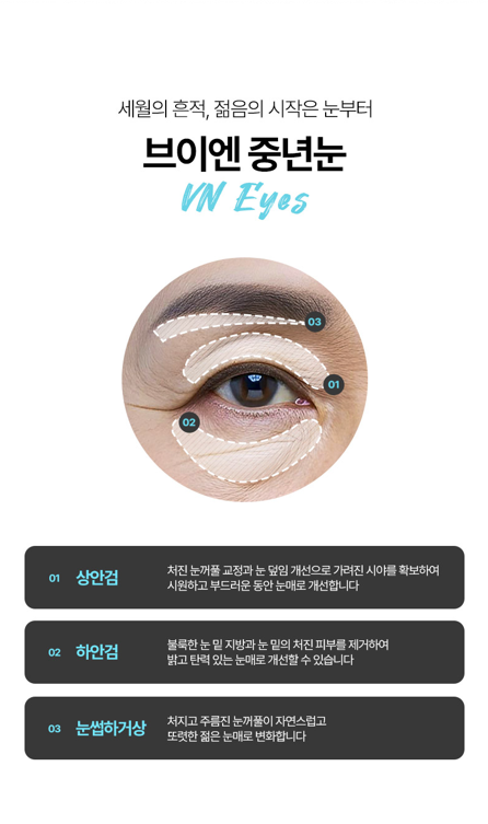 눈밑 처짐을 개선하는 신논현 브이엔성형외과 하안검수술 관련 이미지 5