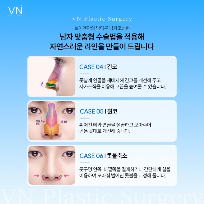 남자코성형, 여자와 다른 디자인과 맞춤형 접근 필요 관련 이미지 4