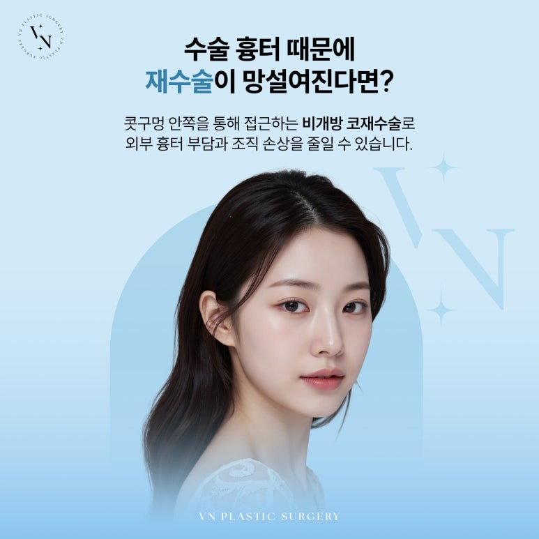 [VN Plastic Surgery] Closed Rhinoplasty Revision: Can It Reduce Scar Concerns and Be Tried Again? image 2