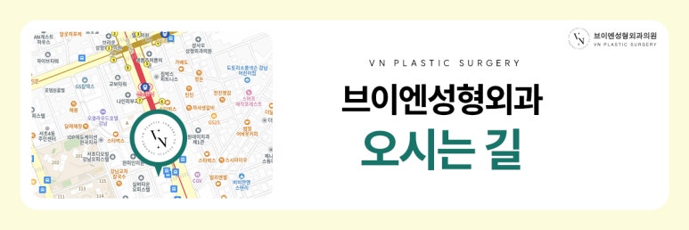 첫눈성형, 인라인 vs 아웃라인 vs 세미아웃 어떻게 고를까? 관련 이미지 9