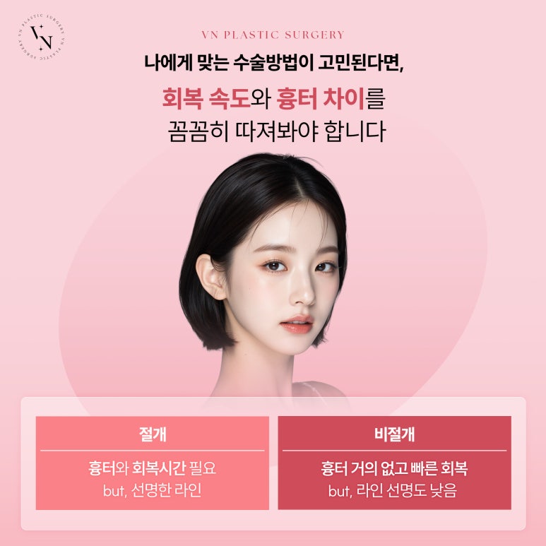첫 눈성형, 절개와 비절개 중 어떤 게 더 좋을까? 관련 이미지 3