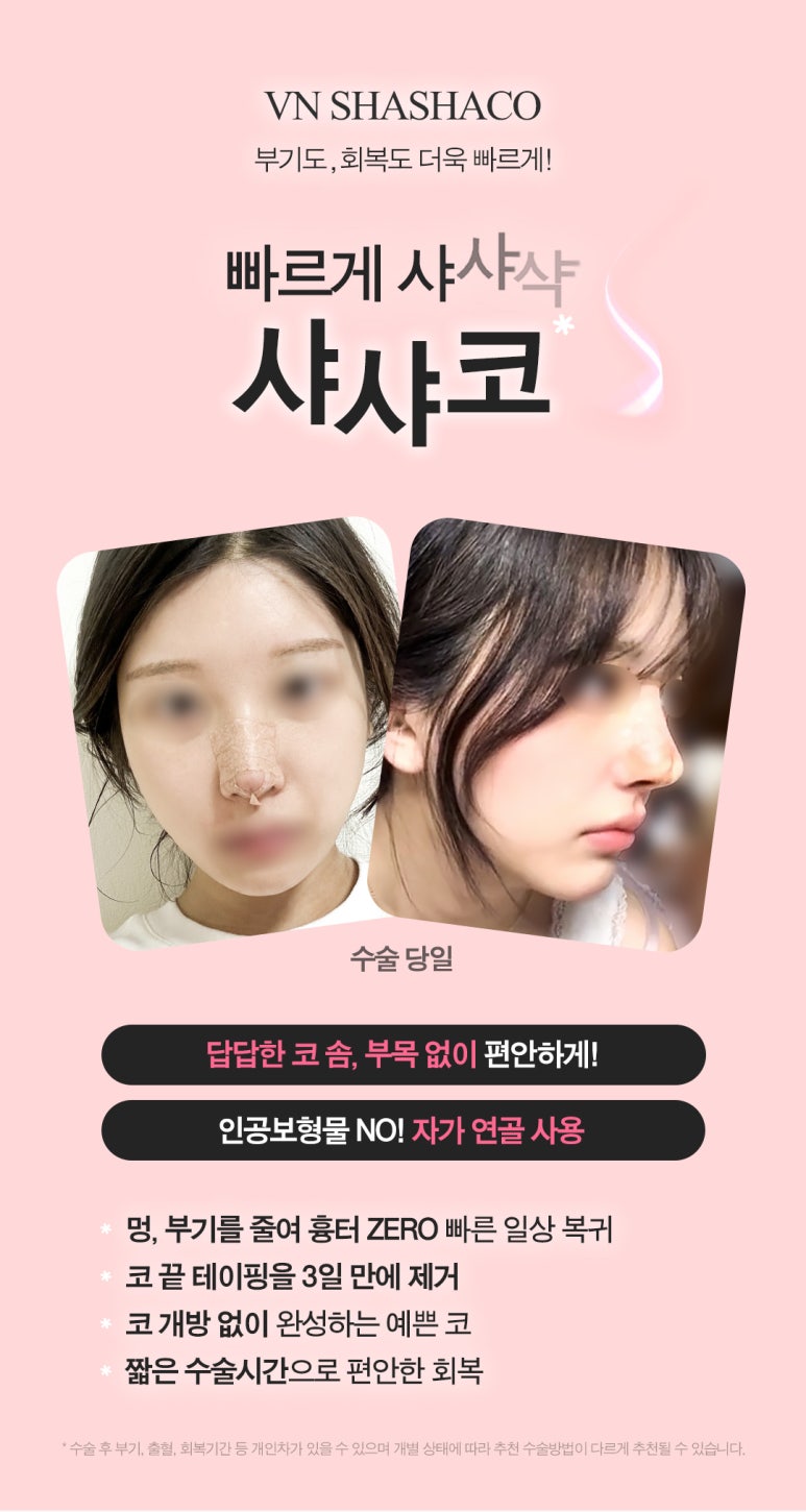 Shinnonhyeon Plastic Surgery, Why Is Closed Rhinoplasty Preferred? From Shasha Nose to Implant-Free Rhinoplasty image 2