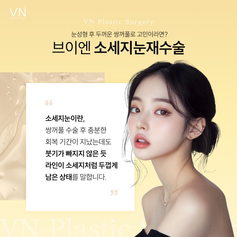 눈성형 실패 후 소세지 눈, 두꺼운 쌍꺼풀로 스트레스 받는다면? 관련 이미지 2