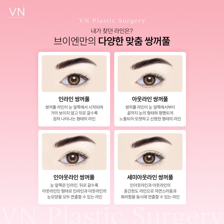 변화하는 눈성형 트렌드와 다양한 쌍꺼풀라인 관련 이미지 2
