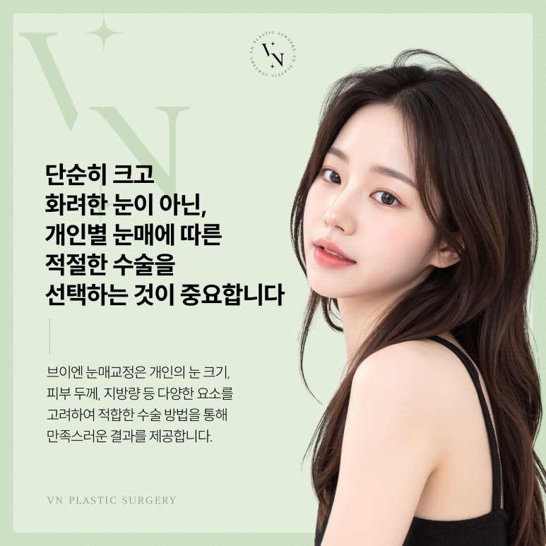 브이엔성형외과, 쌍꺼풀 수술과 눈매교정 차이점은? 관련 이미지 6