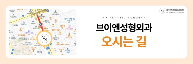 VN Plastic Surgery: If You’re Worried That Your Expression Looks Harsh After Eye Surgery image 8