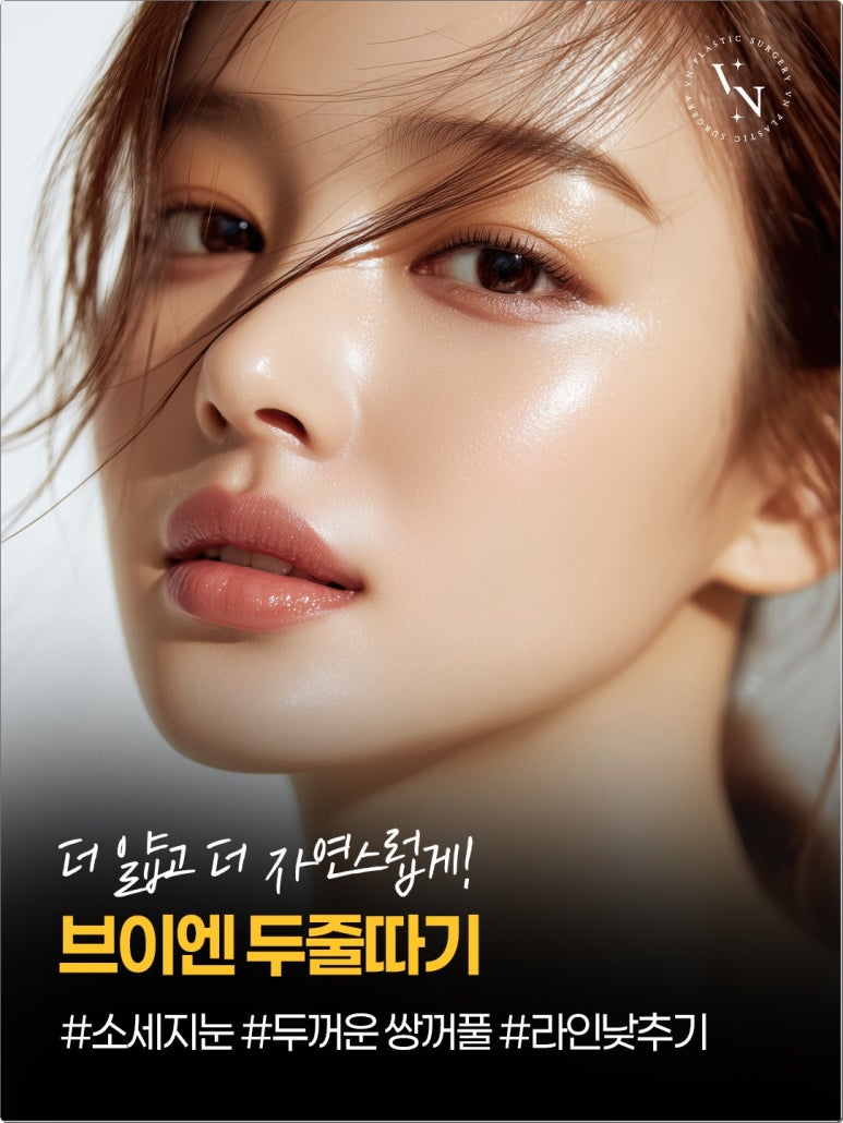 Double-Line Revision: How to Lower a High Double-Eyelid Crease | VN Plastic Surgery image 1